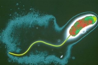 Вспышка холеры в Доминиканской республике