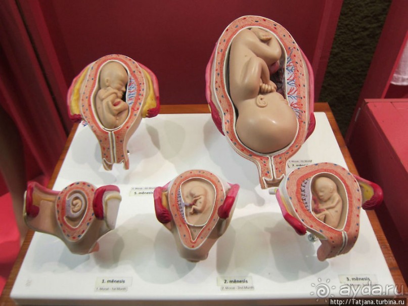 Музей истории медицины им. Паула Страдыня