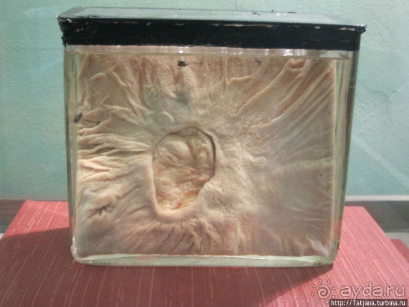 Музей истории медицины им. Паула Страдыня