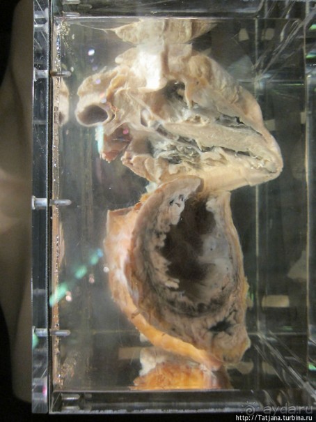 Музей истории медицины им. Паула Страдыня