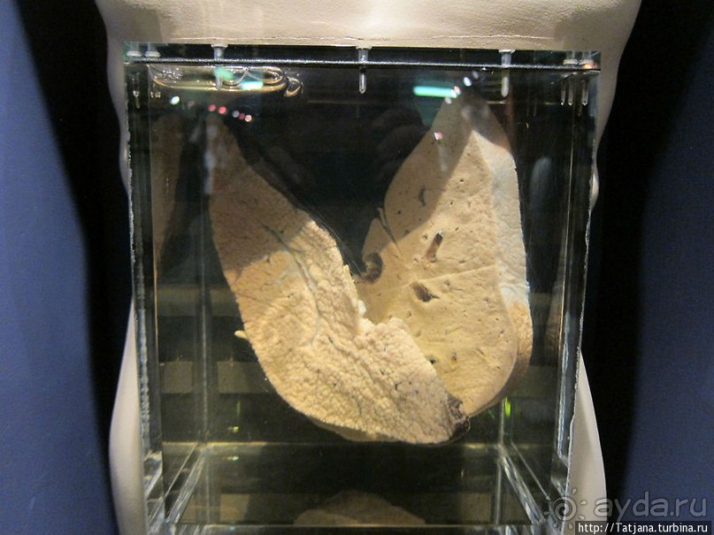 Музей истории медицины им. Паула Страдыня