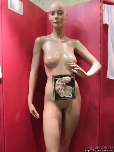 Музей истории медицины им. Паула Страдыня