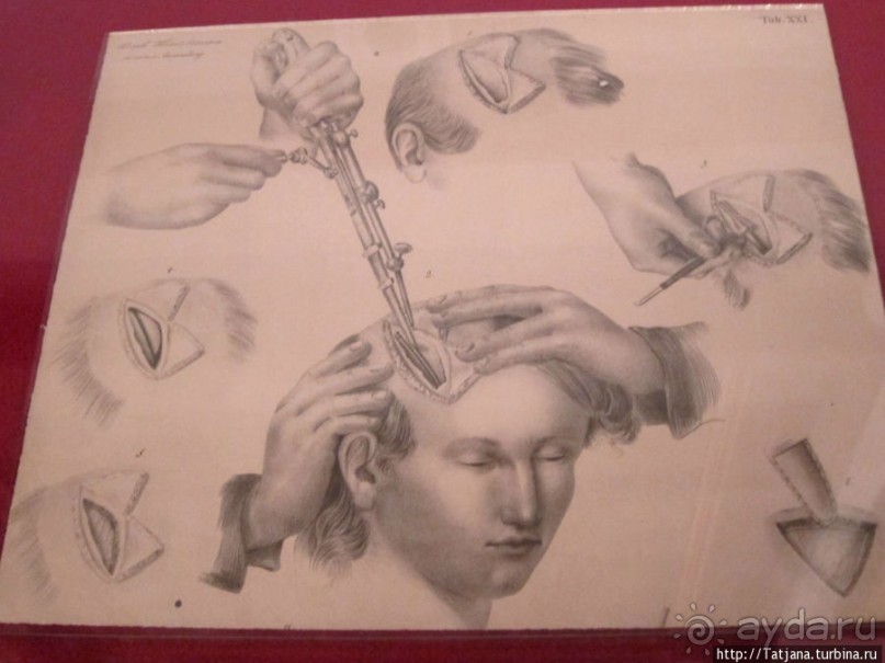 Музей истории медицины им. Паула Страдыня