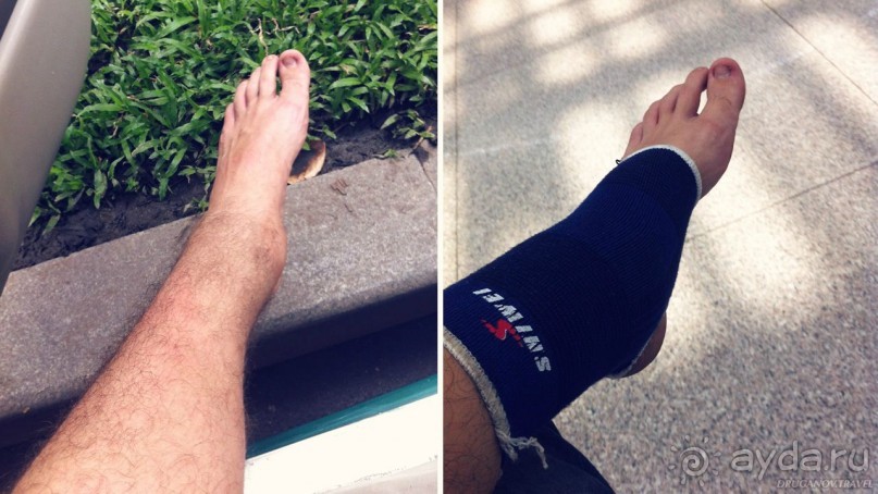 Что делать при обращение в больницу за границей?