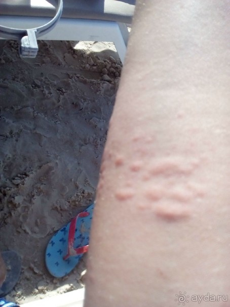 Купаться в море опасно