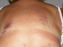 Осторожно,ТУРЦИЯ!!!!