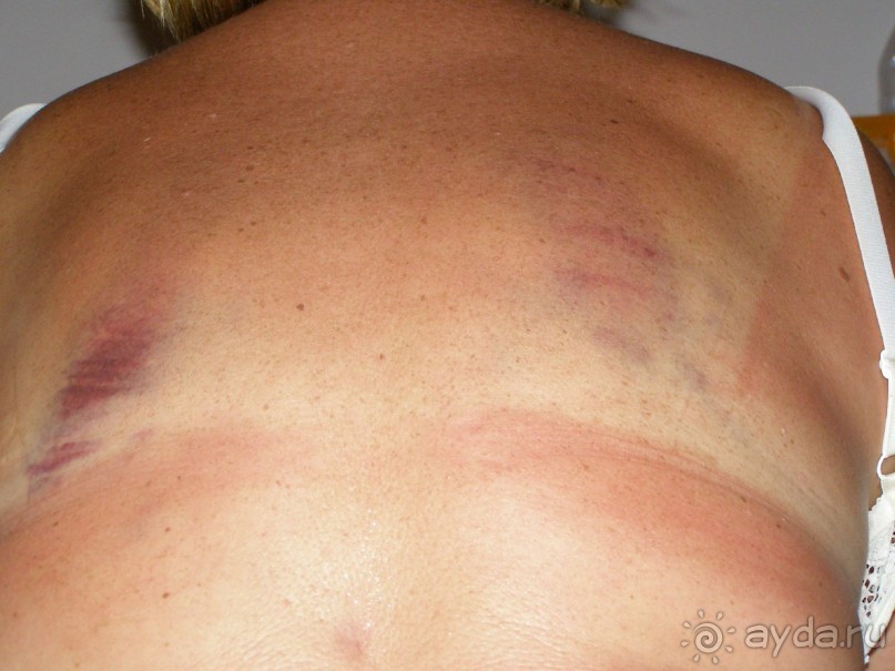 Осторожно,ТУРЦИЯ!!!!